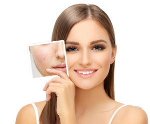 Do acne pills really work