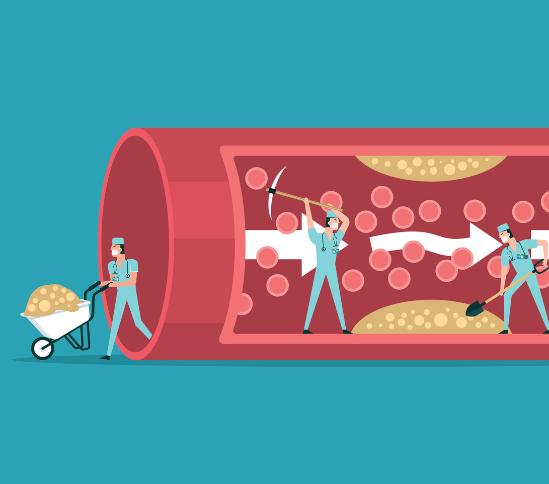 Reducing Cholesterol